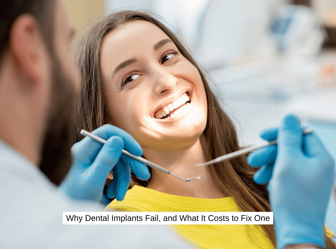 Why Dental Implants Fail, and What It Costs to Fix One